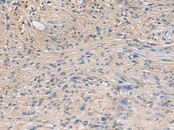 Immunohistochemistry of paraffin-embedded Human brain tissue  using PA2G4 Polyclonal Antibody at dilution of 1:60(?200)