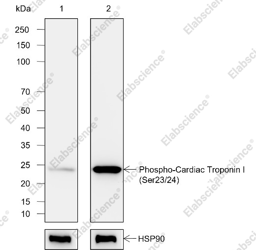 Recombinant Phospho-Cardiac Troponin I (Ser23, Ser24) Monoclonal Antibody - 1