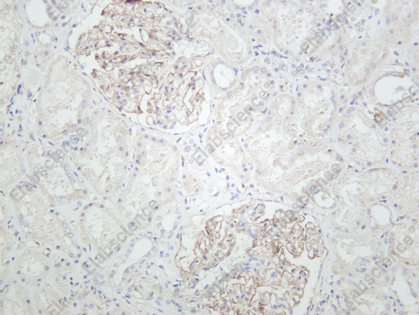 Recombinant ZO1 Monoclonal Antibody - 6