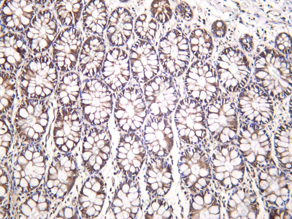 Recombinant eRF3a Monoclonal Antibody - 1