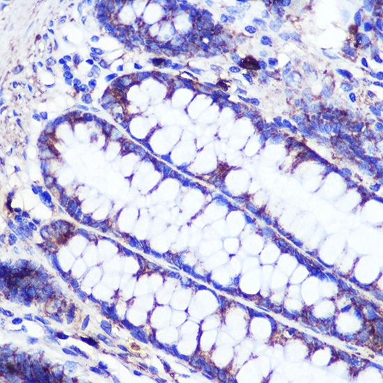 SIRT2 Polyclonal Antibody - small - 6