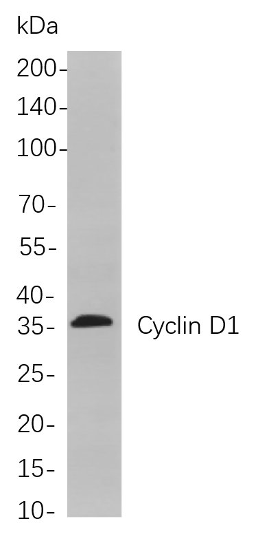Recombinant Cyclin D1 Monoclonal Antibody-searchlist-1