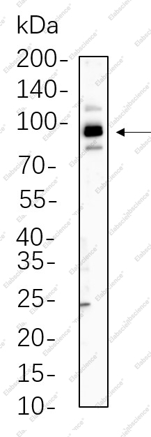 Recombinant STAT5b Monoclonal Antibody - 1