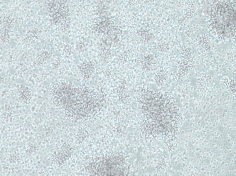 CCRF-SB Cell Complete Medium - 3