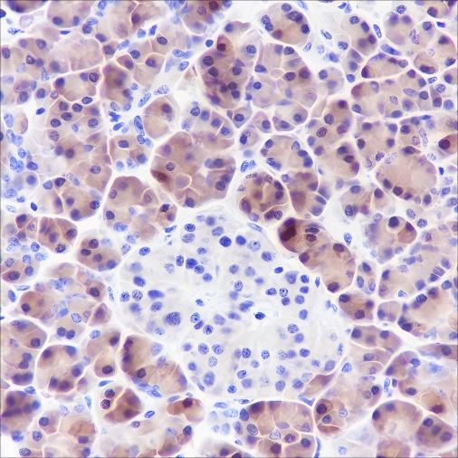 Recombinant SPINK1 Monoclonal Antibody-searchlist-1