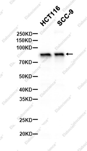 Recombinant gamma Catenin Monoclonal Antibody - 2
