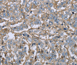 CD32 Polyclonal Antibody - 2
