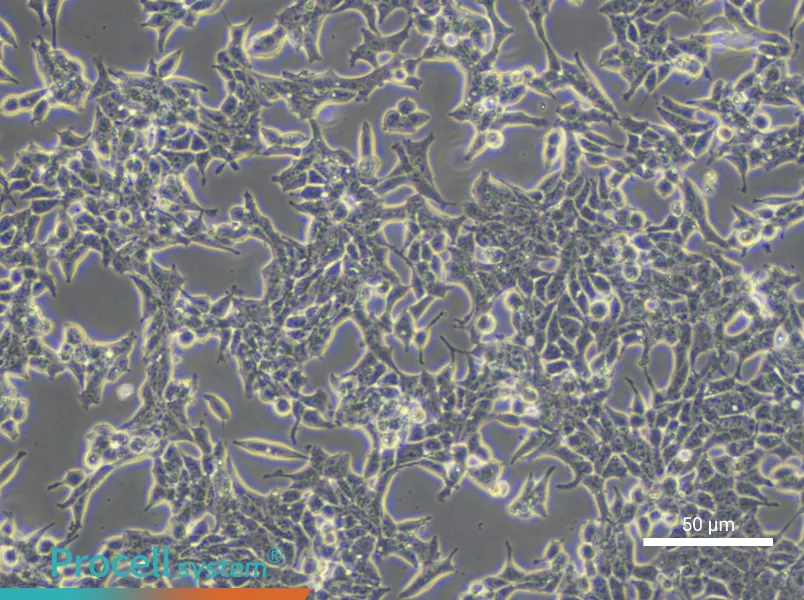 22RV1 Cell Complete Medium - small - 5