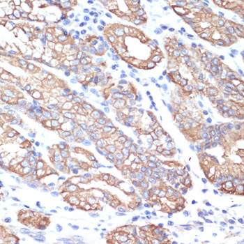 Immunohistochemistry of paraffin-embedded Human small intestine using CytokeRatin-18 Polyclonal Antibody at dilution of  1:100 (40x lens).