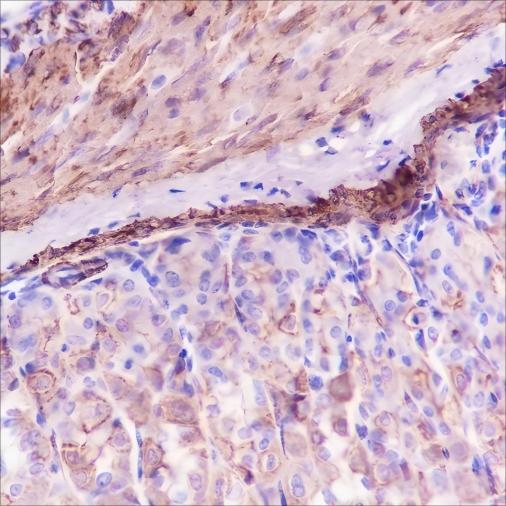 Recombinant alpha smooth muscle Actin Monoclonal Antibody - small - 4
