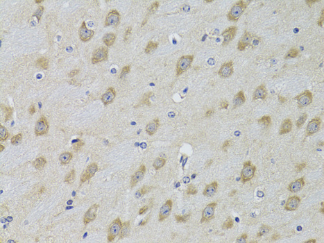 Immunohistochemistry of paraffin-embedded Mouse brain using ADRBK2 Polyclonal Antibody at dilution of 1:100 (40x lens).