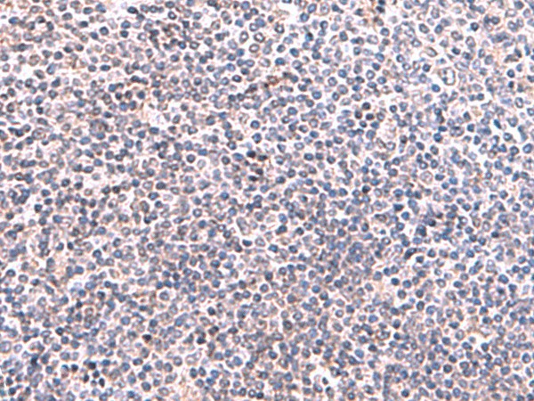 Immunohistochemistry of paraffin-embedded Human tonsil tissue  using KIR3DL1 Polyclonal Antibody at dilution of 1:95(?200)