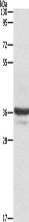 Western Blot analysis of Lovo cell using ANXA3 Polyclonal Antibody at dilution of 1:650