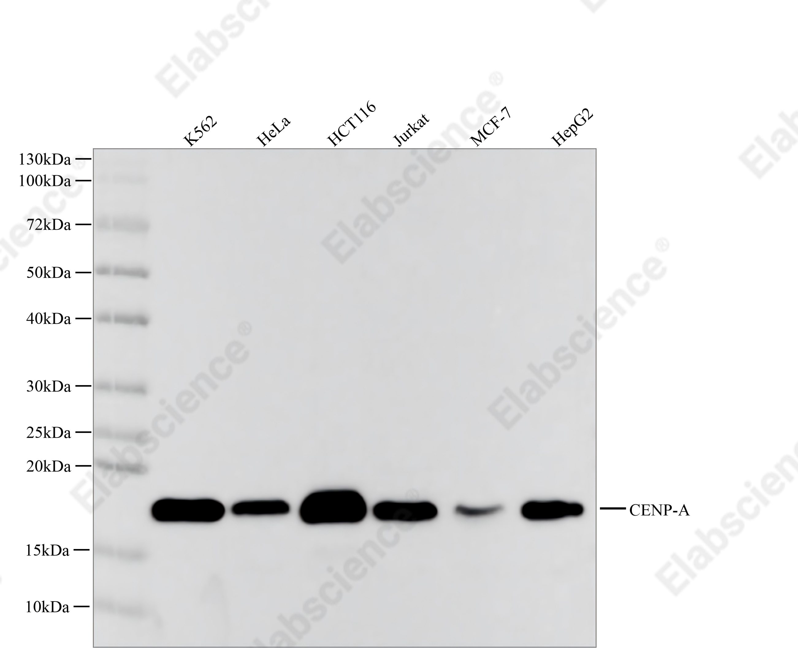 Recombinant CENP-A Monoclonal Antibody - 1