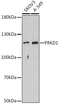 Western blot analysis of extracts of various cell lines using PRKD1 Polyclonal Antibody at dilution of 1:1000.