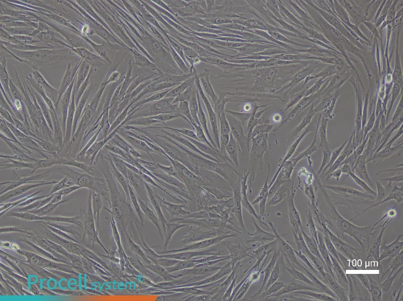 Human Colonic Fibroblast Complete Medium - 2