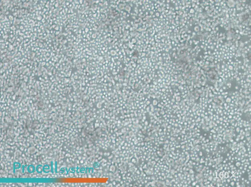 SU-DHL-2 Cell Complete MediumSU-DHL-2 Cell Complete Medium - 2