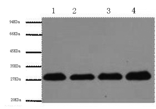 Western Blot analysis of Hela, Rat brain, NIH, 3T3, 293T using Proliferating Cell Nuclear Antigen Monoclonal Antibody at dilution of 1:5000.