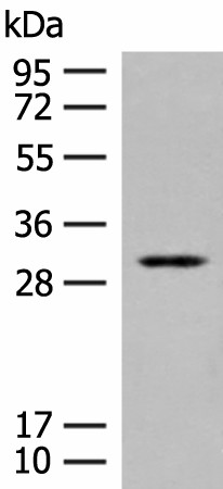 Western blot analysis of Human kidney tissue lysate  using TPMT Polyclonal Antibody at dilution of 1:400