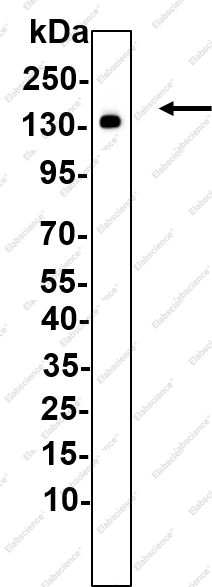 Recombinant HDAC5 Monoclonal Antibody - 1