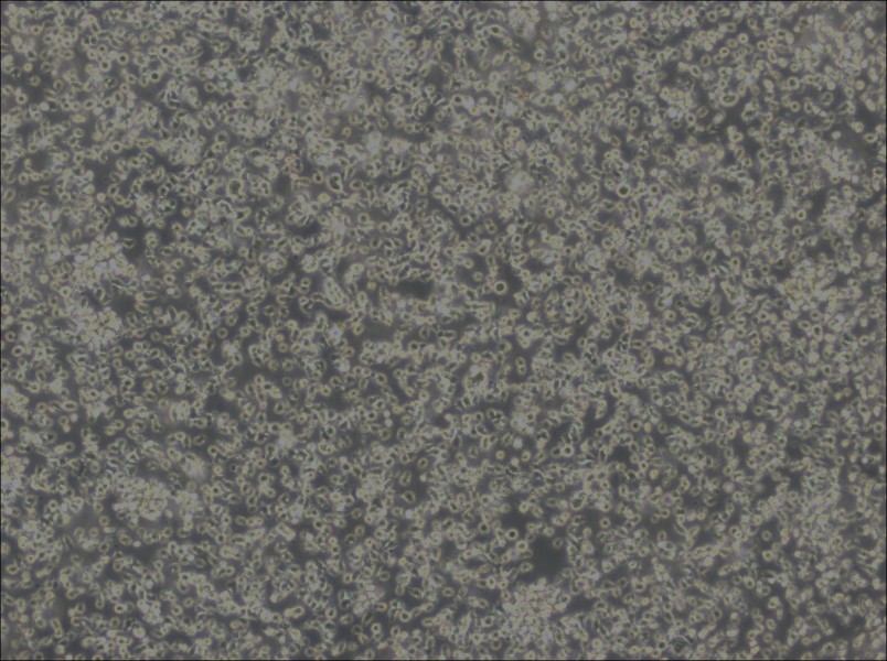 MEC-1 Cell Complete Medium-searchlist-1