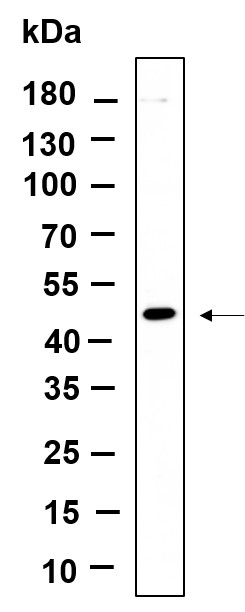 Recombinant DPS1 Monoclonal Antibody-searchlist-1
