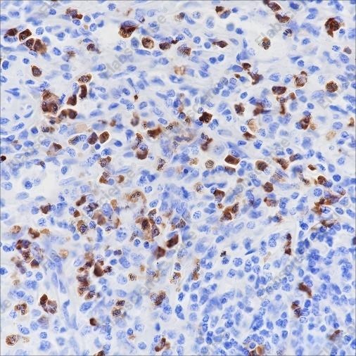 Recombinant CD15/SSEA1 Monoclonal Antibody - 1