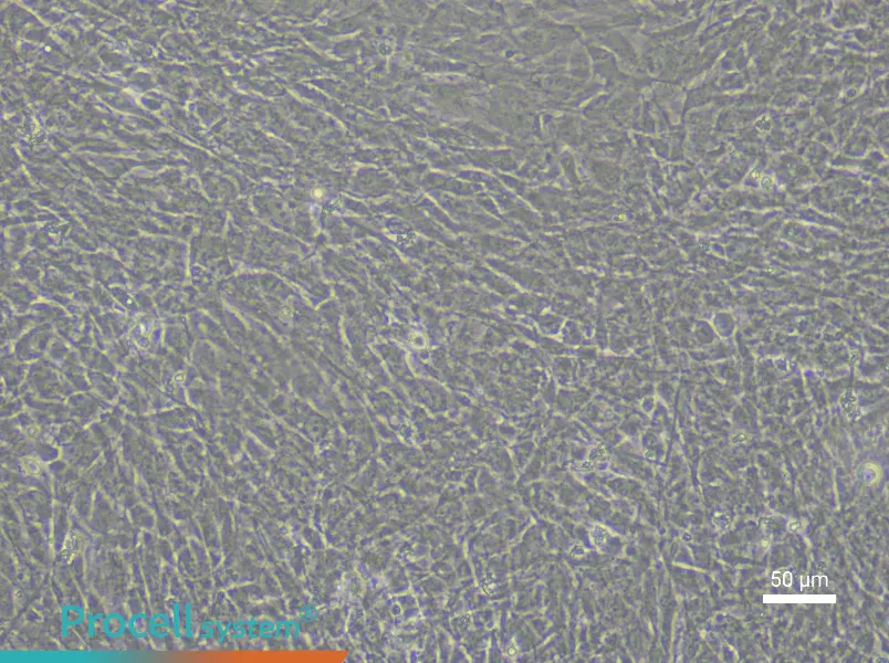 Rabbit Aortic Smooth Muscle Cell Complete Medium - 5