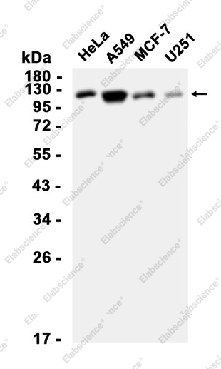 Recombinant BUBR1 Monoclonal Antibody - 1