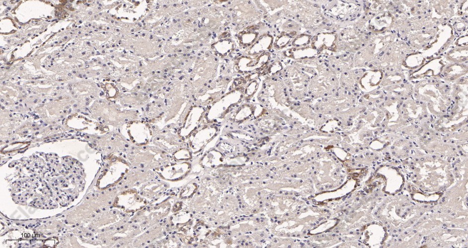 Recombinant SIRT3 Monoclonal Antibody - 2
