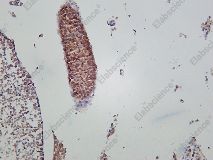 Recombinant PI3-Kinase p85 α Monoclonal Antibody - 4