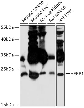 Western blot analysis of extracts of various cell lines using HEBP1 Polyclonal Antibody at 1:1000 dilution.