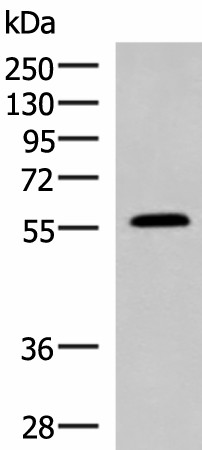 Western blot analysis of Mouse small intestines tissue lysate  using PEPD Polyclonal Antibody at dilution of 1:1000