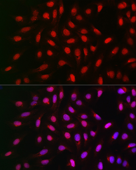 Immunofluorescence analysis of U2OS cells using PPP1CA Polyclonal Antibody at dilution of 1:100 (40x lens). Blue: DAPI for nuclear staining.