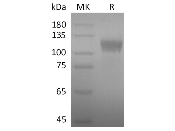 Recombinant 2019-nCoV S1 Protein(Active)
