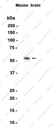 Recombinant MT4-MMP Monoclonal Antibody - 1