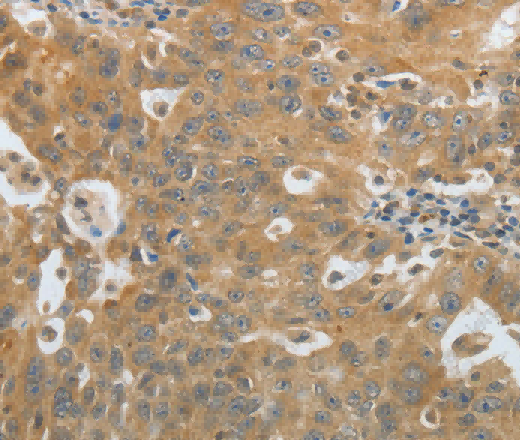 Amphiphysin I Polyclonal Antibody - 2