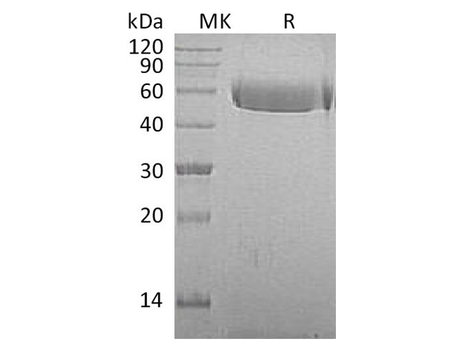 Recombinant Macaca mulatta AHSG/Fetuin A Protein (His Tag)