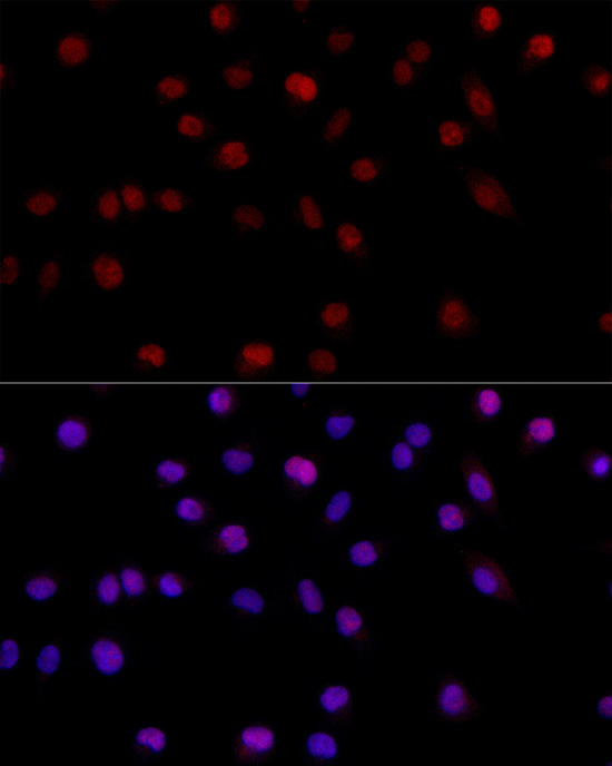 Immunofluorescence analysis of A-549 cells using MSH6 Polyclonal Antibody at dilution of 1:200 (40x lens). Blue: DAPI for nuclear staining.