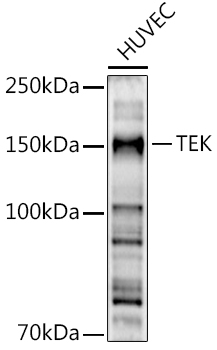 Western blot analysis of extracts of HUVEC cells using TEK Polyclonal Antibody at 1:500 dilution.