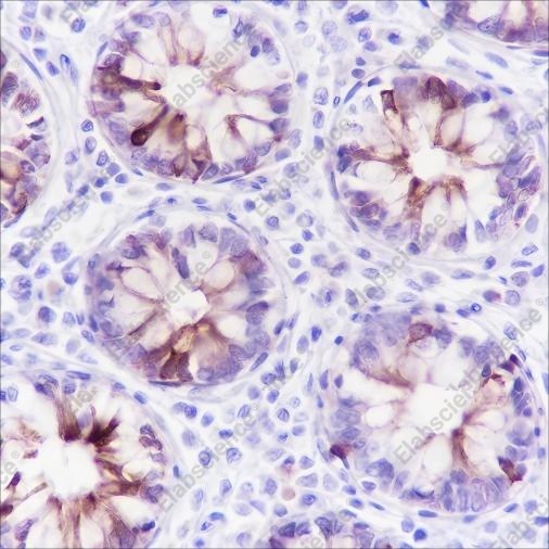 Recombinant MUC4 Monoclonal Antibody - 1
