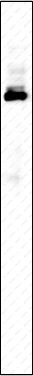 Recombinant BRAT1 Monoclonal Antibody - 1