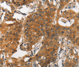 ITGA2 Polyclonal Antibody - 2