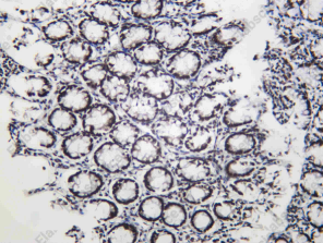 Recombinant DHX9 Monoclonal Antibody - 2