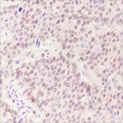 Recombinant Cdc27 Monoclonal Antibody - 2