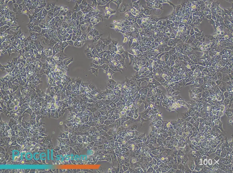 HuH-6 (DMEM) Cell Complete Medium - 1