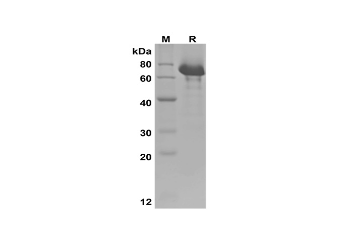 Recombinant Human IGF-1/HSA Fusion Protein(His Tag)-searchlist-1