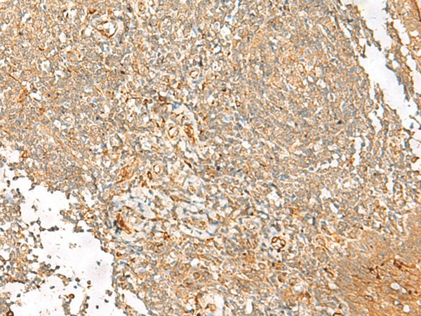 Immunohistochemistry of paraffin-embedded Human tonsil tissue  using FGL2 Polyclonal Antibody at dilution of 1:45(?200)