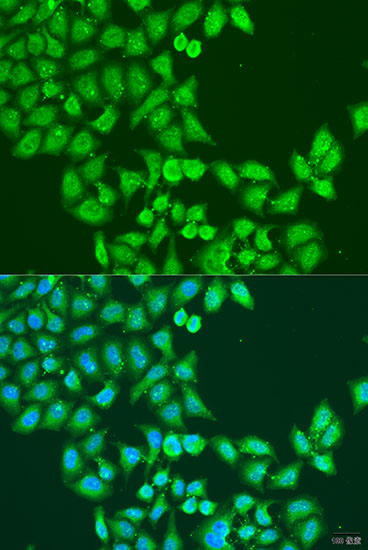 Immunofluorescence analysis of U2OS cells using STAT5A Polyclonal Antibody at dilution of  1:100. Blue: DAPI for nuclear staining.