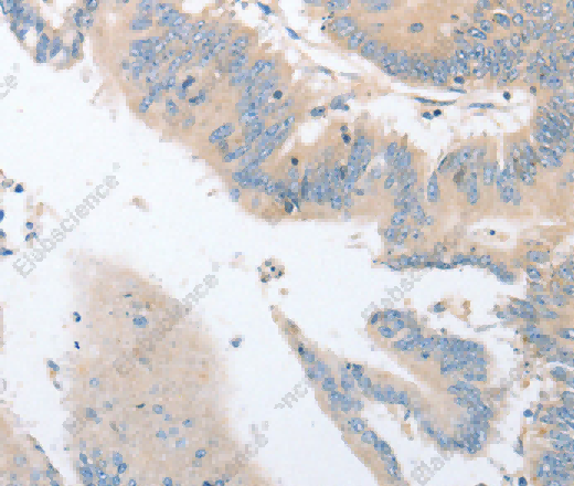 EPS15L1 Polyclonal Antibody - 3